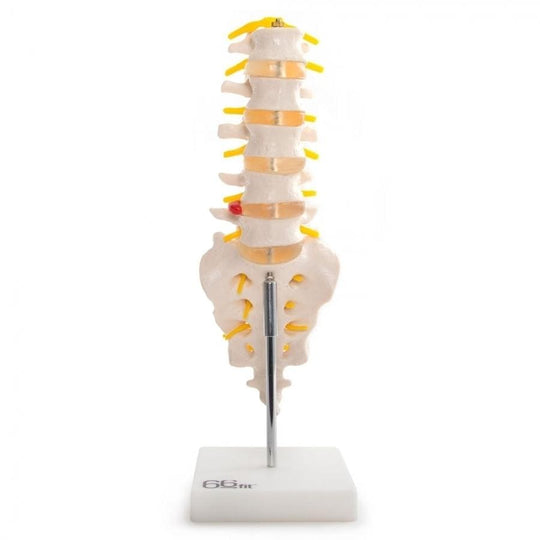 66FIT LUMBAR VERTEBRAE WITH SACRUM/COCCYX/HERNIATE